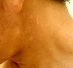 Keputihan+berwarna+coklat